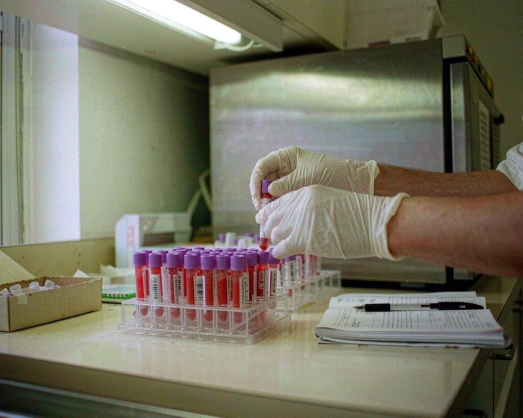 clinical diagnostics lab consumables the complete guide