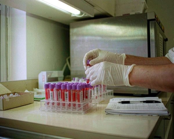 clinical diagnostics lab consumables the complete guide